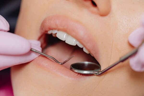 Rehabilitación oral